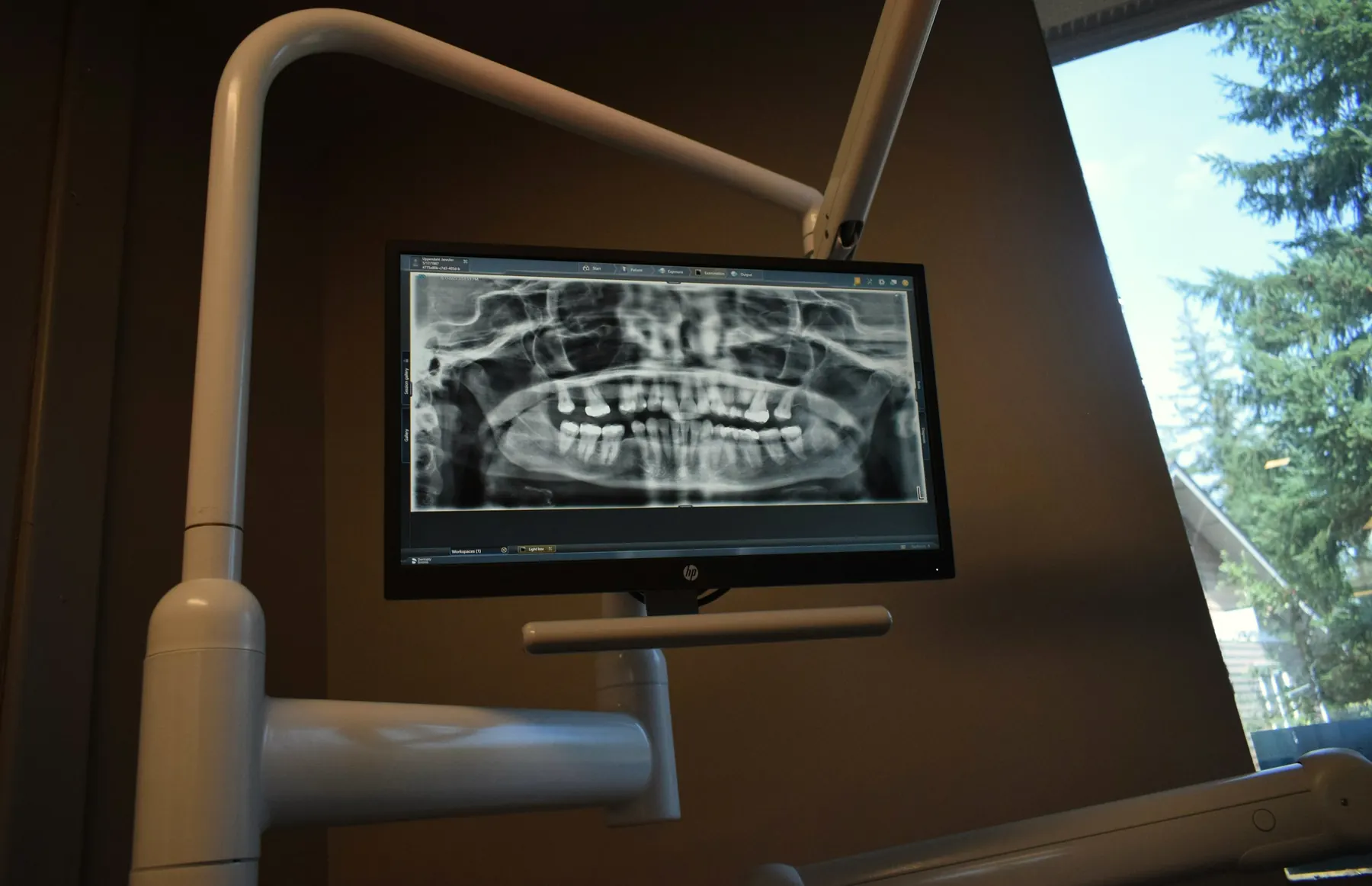 A panoramic X-ray on the monitor over a dental chair, beside a window onto fir trees.